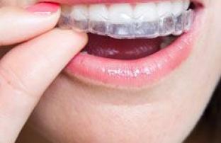 Give Your Teen The Gift of Invisalign